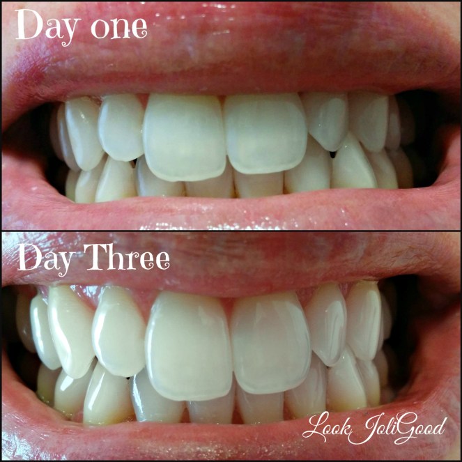 Day One and Day three. Colgate Optic White Toothpaste | lookingjoligood.worpress.com